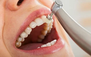 https://jalaramdentalclinics.com/wp-content/uploads/2022/09/2022-06-18-6.webp