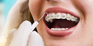 https://jalaramdentalclinics.com/wp-content/uploads/2022/09/2022-06-18-9.webp
