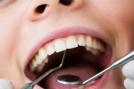 https://jalaramdentalclinics.com/wp-content/uploads/2022/09/portfolio-1x.jpg