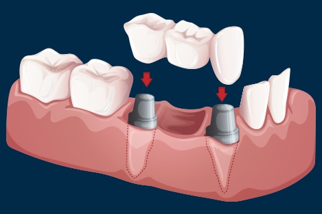 https://jalaramdentalclinics.com/wp-content/uploads/2022/09/portfolio-5x.jpg
