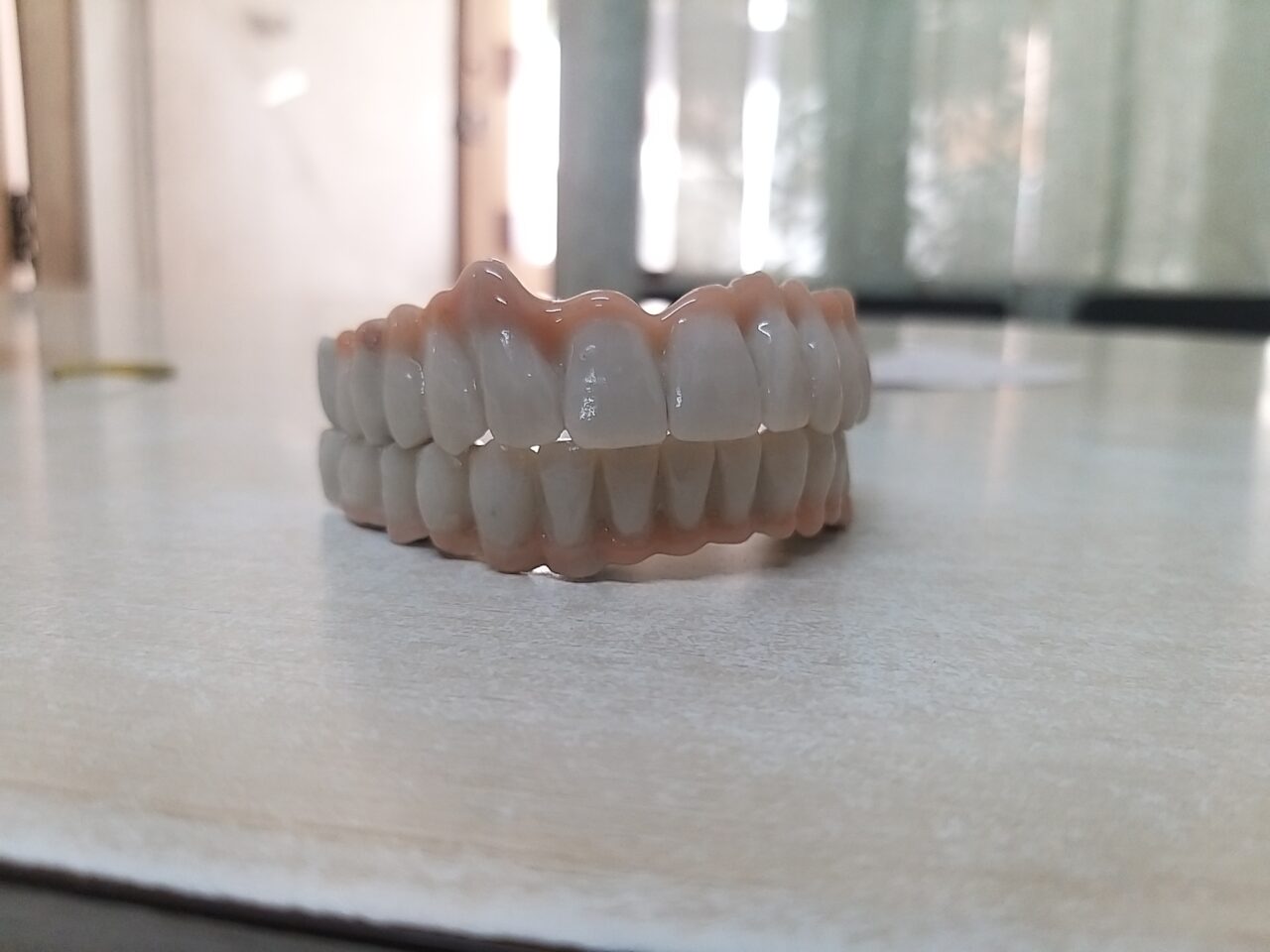 full mouth implant - 1