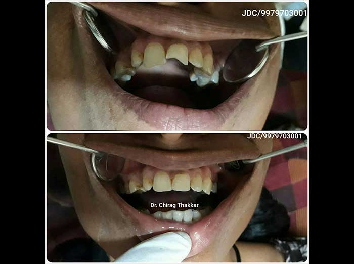 case-3