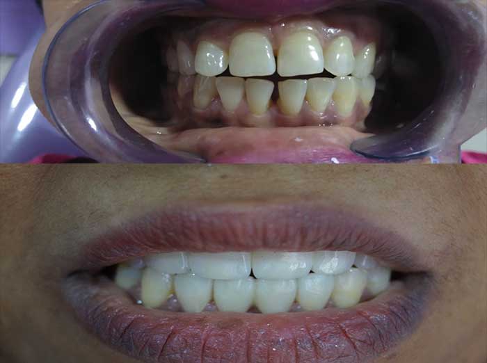 case-8