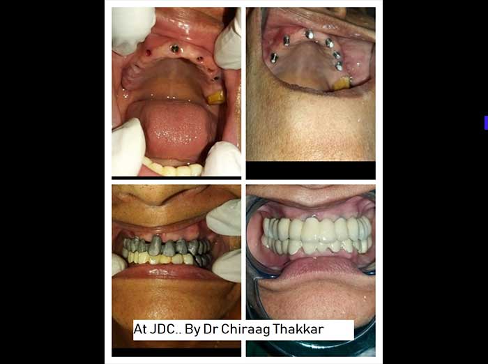 https://jalaramdentalclinics.com/wp-content/uploads/2022/09/pic1.jpg