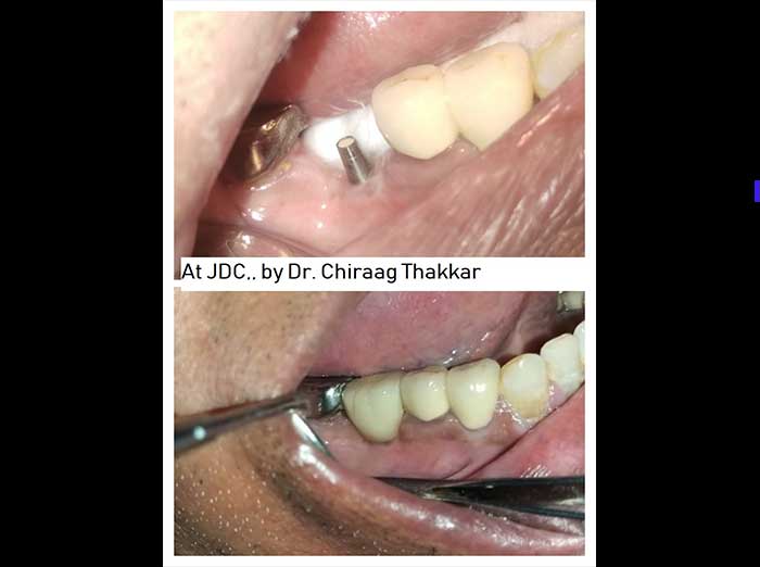 https://jalaramdentalclinics.com/wp-content/uploads/2022/09/pic2.jpg