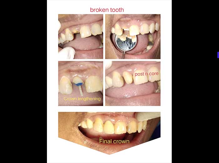 https://jalaramdentalclinics.com/wp-content/uploads/2022/09/pic3.jpg