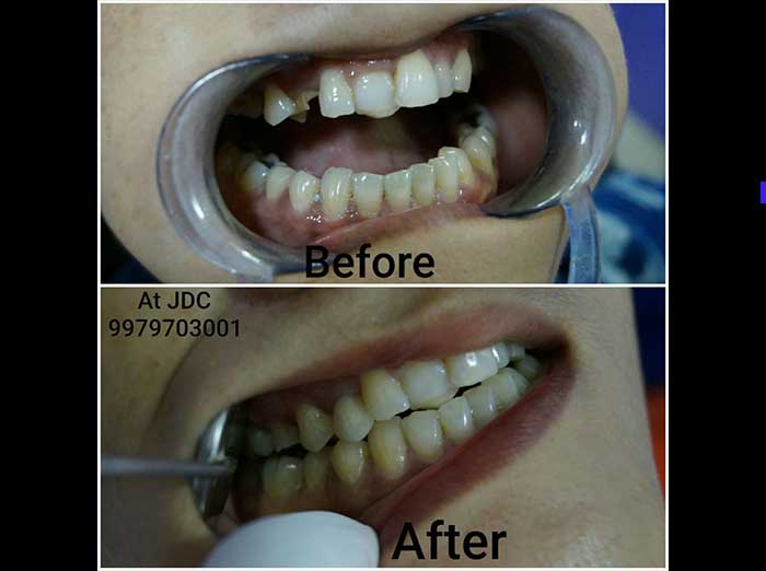 https://jalaramdentalclinics.com/wp-content/uploads/2022/09/pic4.jpg